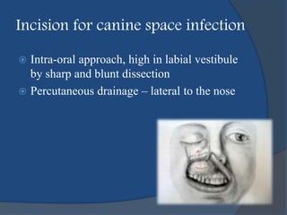 Incision for canine space infection
 Intra-oral approach, high in labial vestibule
by sharp and blunt dissection
 Percutaneous drainage – lateral to the nose
 