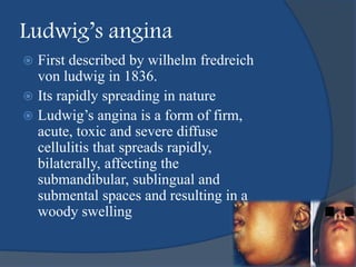 Ludwig’s angina
 First described by wilhelm fredreich
von ludwig in 1836.
 Its rapidly spreading in nature
 Ludwig’s angina is a form of firm,
acute, toxic and severe diffuse
cellulitis that spreads rapidly,
bilaterally, affecting the
submandibular, sublingual and
submental spaces and resulting in a
woody swelling
 
