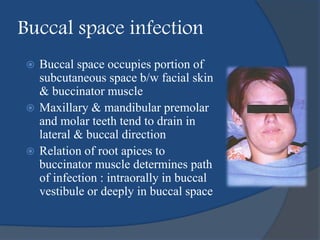Buccal space infection
 Buccal space occupies portion of
subcutaneous space b/w facial skin
& buccinator muscle
 Maxillary & mandibular premolar
and molar teeth tend to drain in
lateral & buccal direction
 Relation of root apices to
buccinator muscle determines path
of infection : intraorally in buccal
vestibule or deeply in buccal space
 