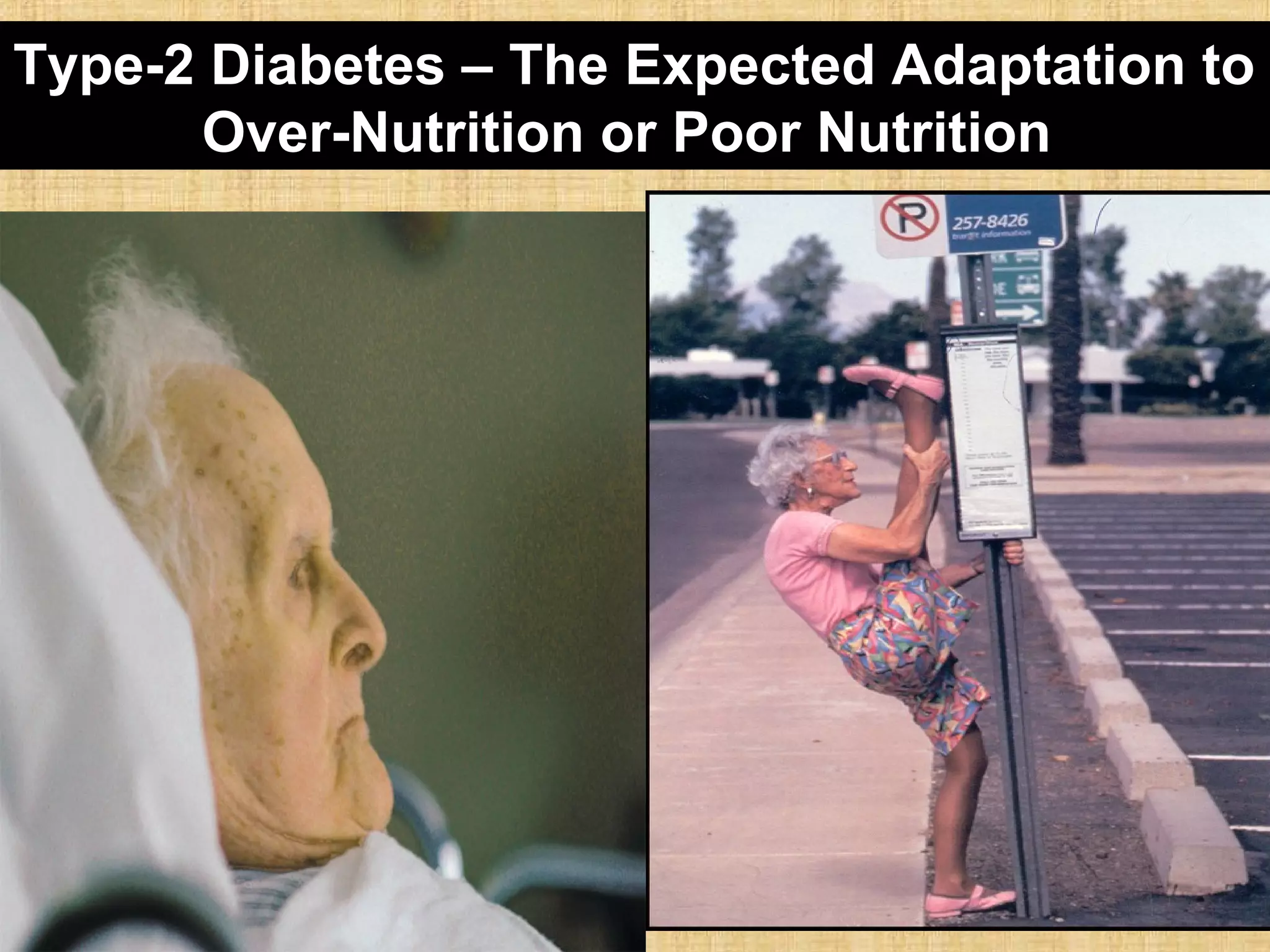  More O2 to cells
 High Lipids
 More energy in Blood
Misdiagnosed
 HTN
 Higher Cholesterol
 Diabetes
Type-2 Diabetes – The Expected Adaptation to
Over-Nutrition or Poor Nutrition
 