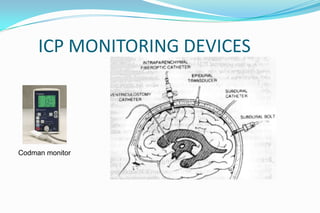 Changes in icp following response checking in icu
