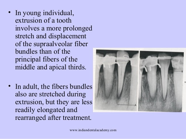 Changes in periodontal ligament