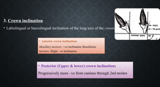 • Anterior crown inclination:
Maxillary incisors- +ve inclination Mandibular
incisors- Slight -ve inclination
3. Crown inclination
• Labiolingual or buccolingual inclination of the long axis of the crown.
• Posterior (Upper & lower) crown inclination:
Progressively more –ve from canines through 2nd molars
 