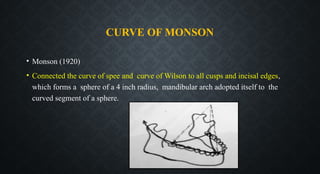 CURVE OF MONSON
• Monson (1920)
• Connected the curve of spee and curve of Wilson to all cusps and incisal edges,
which forms a sphere of a 4 inch radius, mandibular arch adopted itself to the
curved segment of a sphere.
 