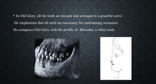 • In Old Glory, all the teeth are present and arranged in a graceful curve.
He emphasizes that all teeth are necessary for maintaining occlusion.
He compares Old Glory with the profile of Belvedre, a white male.
 