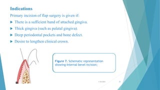 CHAN JOHN PERIO.pptx periodontal flap ppt | PPTX