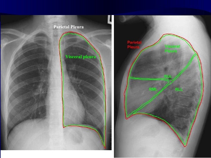 Pulmonary Imaging