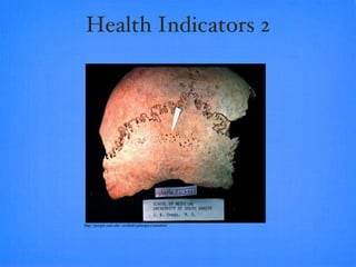 Health Indicators 2 http://people.usd.edu/~archlab/paleopics/metabol/ 