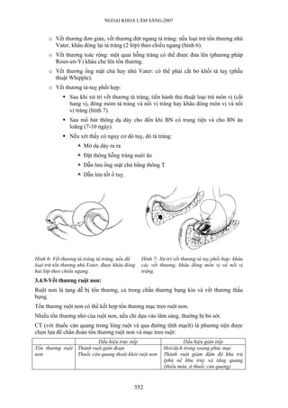 NGOẠI KHOA LÂM SÀNG-2007
o Vết thương đơn giản, vết thương đứt ngang tá tràng: nếu loại trừ tổn thương nhú
Vater, khâu đóng lại tá tràng (2 lớp) theo chiều ngang (hình 6).
o Vết thương toác rộng: một quai hỗng tràng có thể được đưa lên (phương pháp
Roux-en-Y) khâu che lên tổn thương.
o Vết thương ống mật chủ hay nhú Vater: có thể phải cắt bỏ khối tá tuỵ (phẫu
thuật Whipple).
o Vết thương tá-tuỵ phối hợp:
Sau khi xử trí vết thương tá tràng, tiến hành thủ thuật loại trừ môn vị (cắt
hang vị, đóng mỏm tá tràng và nối vị tràng hay khâu đóng môn vị và nối
vị tràng (hình 7).
Sau mổ hút thông dạ dày cho đến khi BN có trung tiện và cho BN ăn
loãng (7-10 ngày).
Nếu xét thấy có nguy cơ dò tuỵ, dò tá tràng:
Mở dạ dày ra ra
Đặt thông hỗng tràng nuôi ăn
Dẫn lưu ống mật chủ bằng thông T
Dẫn lưu tốt ổ tuỵ.
Hình 6- Vết thương tá tràng tá tràng, nếu đã
loại trừ tổn thương nhú Vater, được khâu đóng
hai lớp theo chiều ngang.
Hình 7- Xử trí vết thương tá tuỵ phối hợp: khâu
các vết thương, khâu đóng môn vị và nối vị
tràng.
3.4.9-Vết thương ruột non:
Ruột non là tạng dễ bị tổn thương, cả trong chấn thương bụng kín và vết thương thấu
bụng.
Tổn thương ruột non có thể kết hợp tổn thương mạc treo ruột non.
Nhiều tổn thương nhỏ của ruột non, nếu chỉ dựa vào lâm sàng, thường bị bỏ sót.
CT (với thuốc cản quang trong lòng ruột và qua đường tĩnh mạch) là phương tiện được
chọn lựa để chẩn đoán tổn thương ruột non và mạc treo ruột:
Dấu hiệu trực tiếp Dấu hiệu gián tiếp
Tổn thương ruột
non
Thành ruột gián đoạn
Thuốc cản quang thoát khỏi ruột non
Hơi/dịch trong xoang phúc mạc
Thành ruột giảm đậm độ khu trú
(phù nề khu trú) và tăng quang
(thiếu máu, ứ thuốc cản quang)
552
 