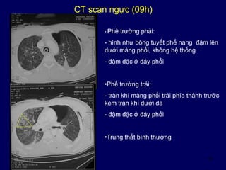 18
CT scan ngực (09h)
• Phế trường phải:
- hình như bông tuyết phế nang đậm lên
dưới màng phổi, không hệ thống
- đậm đặc ở đáy phổi
•Phế trường trái:
- tràn khí màng phổi trái phía thành trước
kèm tràn khí dưới da
- đậm đặc ở đáy phổi
•Trung thất bình thường
 