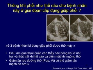 36
Thông khí phổi như thế nào cho bệnh nhân
này ở giai đoạn cấp đụng giập phổi ?
«ở 3 bệnh nhân bị đụng giập phổi được thở máy »
• Siêu âm qua thực quản cho thấy các bóng khí ở nhĩ
trái và thất trái khi hít vào và biến mất khi ngừng thở
• Giảm áp lực đường thở (Pep, Vt) có thể giảm tắc
mạch do hơi »
Saada M, Am J Respir Crit Care Med,1995
 