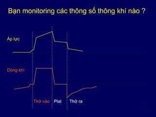 50
Bạn monitoring các thông số thông khí nào ?
Áp lực
Dòng khí
Thở vào Plat Thở ra
 