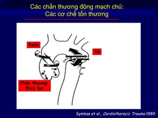 67
Xé
Xoắn
Chấn thương
thủy lực
Symbas et al., Cardiothoracic Trauma 1989
Các chấn thương động mạch chủ:
Các cơ chế tổn thương
 