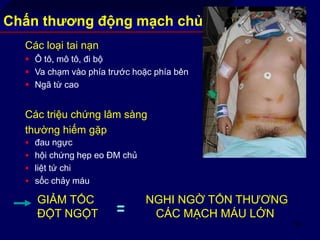 69
Chấn thương động mạch chủ
Các loại tai nạn
 Ô tô, mô tô, đi bộ
 Va chạm vào phía trước hoặc phía bên
 Ngã từ cao
Các triệu chứng lâm sàng
thường hiếm gặp
 đau ngực
 hội chứng hẹp eo ĐM chủ
 liệt tứ chi
 sốc chảy máu
GIẢM TỐC NGHI NGỜ TỔN THƯƠNG
ĐỘT NGỘT CÁC MẠCH MÁU LỚN=
 