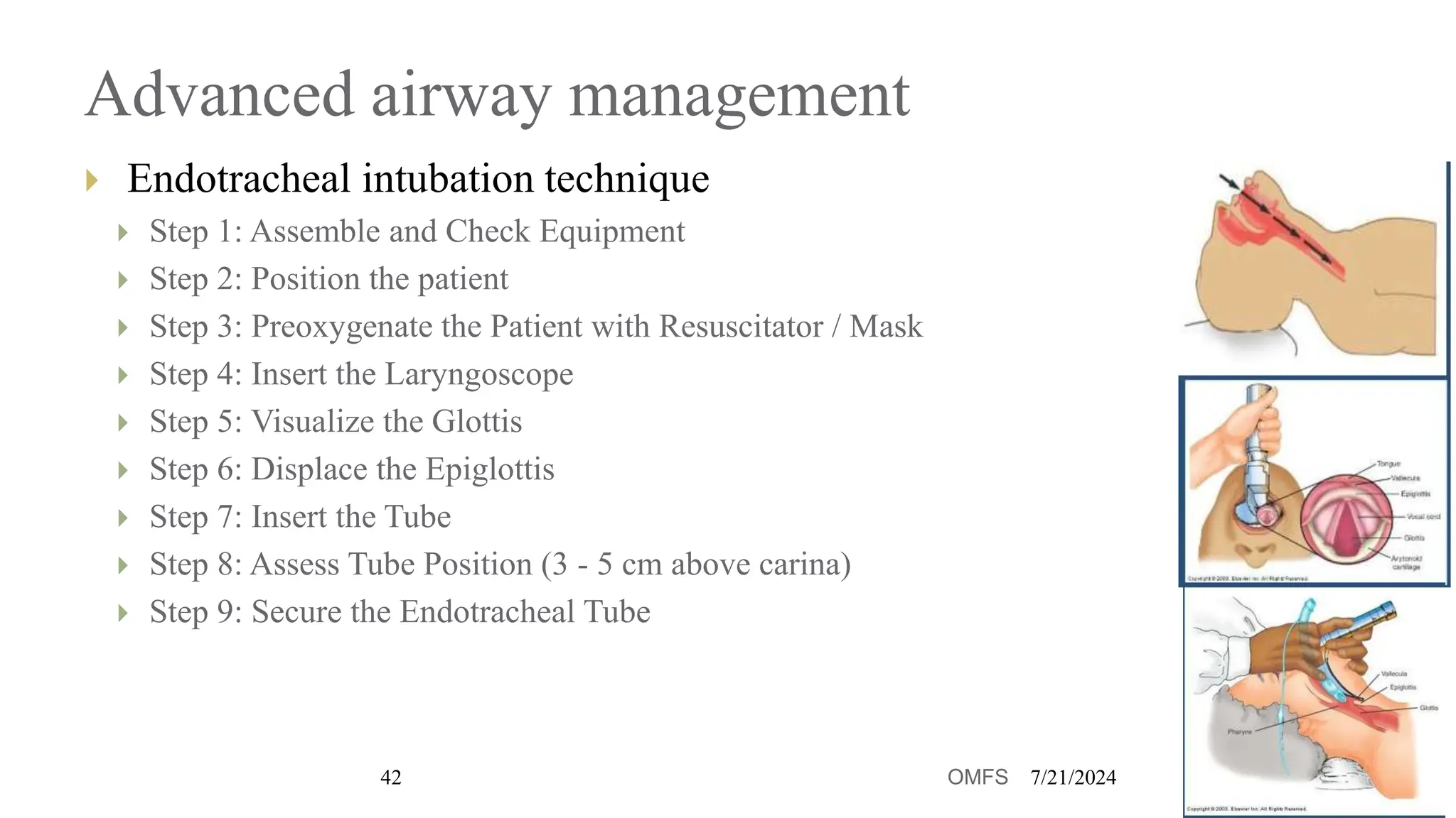 chap-3a Initial management of ocmfs trauma ATLS.pptx