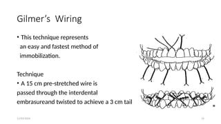 11/03/2024 14
Gilmer’s Wiring
• This technique represents
an easy and fastest method of
immobilization.
Technique
• A 15 cm pre-stretched wire is
passed through the interdental
embrasureand twisted to achieve a 3 cm tail
 