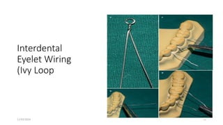 11/03/2024 23
Interdental
Eyelet Wiring
(Ivy Loop
 