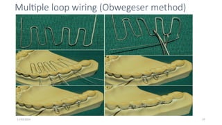 11/03/2024 29
Multiple loop wiring (Obwegeser method)
 
