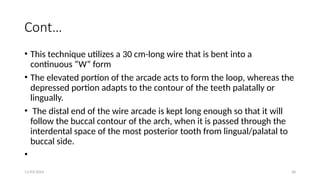 11/03/2024 30
Cont…
• This technique utilizes a 30 cm-long wire that is bent into a
continuous “W” form
• The elevated portion of the arcade acts to form the loop, whereas the
depressed portion adapts to the contour of the teeth palatally or
lingually.
• The distal end of the wire arcade is kept long enough so that it will
follow the buccal contour of the arch, when it is passed through the
interdental space of the most posterior tooth from lingual/palatal to
buccal side.
•
 