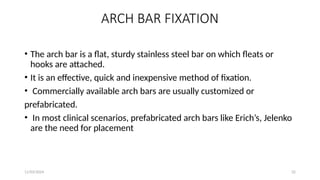 11/03/2024 32
ARCH BAR FIXATION
• The arch bar is a flat, sturdy stainless steel bar on which fleats or
hooks are attached.
• It is an effective, quick and inexpensive method of fixation.
• Commercially available arch bars are usually customized or
prefabricated.
• In most clinical scenarios, prefabricated arch bars like Erich’s, Jelenko
are the need for placement
 