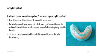 11/03/2024 37
acrylic splint
Lateral compression splint/ open cap acrylic splint
• for the stabilization of mandibular arch.
• Mainly used in cases of children, where there is
mixed dentition and presence of developing teeth
buds
• It can be also used in adult mandibular body
fracture,
 