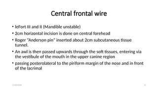 11/03/2024 51
Central frontal wire
• leFort III and II (Mandible unstable)
• 2cm horizontal incision is done on central forehead
• Roger “Anderson pin” inserted about 2cm subcutaneous tissue
tunnel.
• An awl is then passed upwards through the soft tissues, entering via
the vestibule of the mouth in the upper canine region
• passing posterolateral to the piriform margin of the nose and in front
of the lacrimal
 