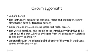11/03/2024 53
Circum zygomatic
• Le Fort II and I
• The instrument pierces the temporal fascia and keeping the point
close to the deep or temporal surface
• enter the upper buccal sulcus in the first molar region.
• The wire is attached, and the tip of the introducer withdrawn to lie
just above the arch without emerging from the skin and movelateral
to and down to the arch
• emerge through the original point of entry of the wire in the buccal
sulcus and fix on arch bar
 
