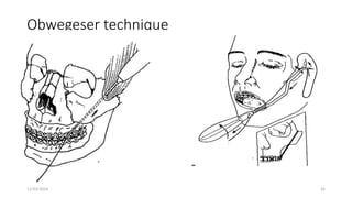 11/03/2024 54
Obwegeser technique
 