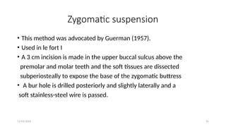 11/03/2024 55
Zygomatic suspension
• This method was advocated by Guerman (1957).
• Used in le fort I
• A 3 cm incision is made in the upper buccal sulcus above the
premolar and molar teeth and the soft tissues are dissected
subperiosteally to expose the base of the zygomatic buttress
• A bur hole is drilled posteriorly and slightly laterally and a
soft stainless-steel wire is passed.
 