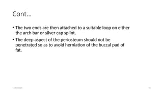 11/03/2024 56
Cont…
• The two ends are then attached to a suitable loop on either
the arch bar or silver cap splint.
• The deep aspect of the periosteum should not be
penetrated so as to avoid herniation of the buccal pad of
fat.
 