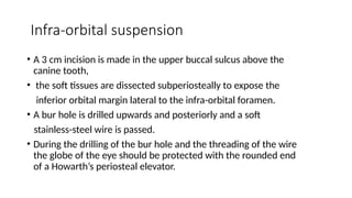 Infra-orbital suspension
• A 3 cm incision is made in the upper buccal sulcus above the
canine tooth,
• the soft tissues are dissected subperiosteally to expose the
inferior orbital margin lateral to the infra-orbital foramen.
• A bur hole is drilled upwards and posteriorly and a soft
stainless-steel wire is passed.
• During the drilling of the bur hole and the threading of the wire
the globe of the eye should be protected with the rounded end
of a Howarth’s periosteal elevator.
 