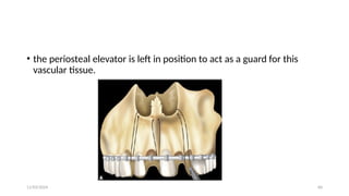 11/03/2024 60
• the periosteal elevator is left in position to act as a guard for this
vascular tissue.
 