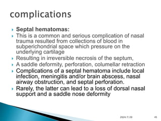 chap-3d fracture of nasal bone maxillofacial surgery.pptx