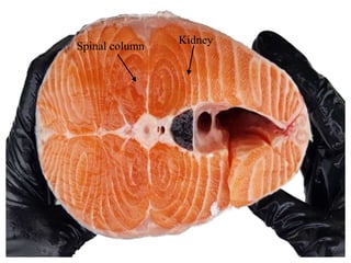 Kidney
Spinal column
 