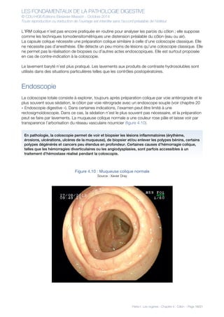LES FONDAMENTAUX DE LA PATHOLOGIE DIGESTIVE
© CDU-HGE/Editions Elesevier-Masson - Octobre 2014
Toute reproduction ou traduction de l’ouvrage est interdite sans l’accord préalable de l’éditeur
Partie I : Les organes - Chapitre 4 : Côlon - Page 16/21
L’IRM colique n’est pas encore pratiquée en routine pour analyser les parois du côlon ; elle suppose
comme les techniques tomodensitométriques une distension préalable du côlon (eau ou air).
La capsule colique nécessite une préparation colique similaire à celle d’une coloscopie classique. Elle
ne nécessite pas d’anesthésie. Elle détecte un peu moins de lésions qu’une coloscopie classique. Elle
ne permet pas la réalisation de biopsies ou d’autres actes endoscopiques. Elle est surtout proposée
en cas de contre-indication à la coloscopie.
Le lavement baryté n’est plus pratiqué. Les lavements aux produits de contraste hydrosolubles sont
utilisés dans des situations particulières telles que les contrôles postopératoires.
Endoscopie
La coloscopie totale consiste à explorer, toujours après préparation colique par voie antérograde et le
plus souvent sous sédation, le côlon par voie rétrograde avec un endoscope souple (voir chapitre 20
« Endoscopie digestive »). Dans certaines indications, l’examen peut être limité à une
rectosigmoïdoscopie. Dans ce cas, la sédation n’est le plus souvent pas nécessaire, et la préparation
peut se faire par lavements. La muqueuse colique normale a une couleur rose pâle et laisse voir par
transparence l’arborisation du réseau vasculaire nourricier (figure 4.10).
Figure 4.10 : Muqueuse colique normale
Source : Xavier Dray
En pathologie, la coloscopie permet de voir et biopsier les lésions inflammatoires (érythème,
érosions, ulcérations, ulcères de la muqueuse), de biopsier et/ou enlever les polypes bénins, certains
polypes dégénérés et cancers peu étendus en profondeur. Certaines causes d’hémorragie colique,
telles que les hémorragies diverticulaires ou les angiodysplasies, sont parfois accessibles à un
traitement d’hémostase réalisé pendant la coloscopie.
 