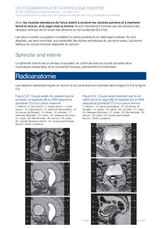 LES FONDAMENTAUX DE LA PATHOLOGIE DIGESTIVE
© CDU-HGE/Editions Elesevier-Masson - Octobre 2014
Toute reproduction ou traduction de l’ouvrage est interdite sans l’accord préalable de l’éditeur
Partie I : Les organes - Chapitre 5 : Rectum-Canal anal - Page 11/21
Ainsi, les muscles élévateurs de l’anus aident à soutenir les viscères pelviens et à maintenir
fermé le rectum, et le vagin chez la femme. Ils sont directement innervés par des divisions des
rameaux ventraux de S4 et par des divisions du nerf pudendal (S2 à S4).
Les deux muscles coccygiens complètent la partie postérieure du diaphragme pelvien. Ils sont
attachés, par leurs sommets, aux extrémités des épines ischiatiques et, par leurs bases, aux bords
latéraux du coccyx et bords adjacents du sacrum.
Sphincter anal interne
Le sphincter interne est un anneau musculaire, en continuité avec la couche circulaire de la
musculeuse rectale lisse, et en contraction tonique, permanente et involontaire.
Radioanatomie
Les rapports radioanatomiques du rectum et du canal anal sont précisés dans la figure 5.8 et la figure
5.9.
Figure 5.8 : Coupe axiale (A), passant par la
prostate, et sagittale (B) en IRM (séquence
pondérée T2) d’un pelvis masculin
1. Rectum ; 2. bas rectum ; 3. moyen rectum ; 4. haut
rectum ; 10. mésorectum ; 12. fascia de Denonvilliers ; 14.
cul-de-sac de Douglas ; 15. vessie ; 16. prostate ; 17.
vésicules séminales ; 23. urètre ; 25. vaisseaux fémoraux ;
27. cotyle ; 28. tête fémorale ; 29. sacrum ; 30. pubis ;
32. muscle obturateur interne ; 34. muscle grand fessier.
Source : Olivier Lucidarme
Figure 5.9 : Coupe axiale (passant par le col
utérin [A] et le vagin [B]) et sagittale (C) en IRM
(séquence pondérée T2) d’un pelvis féminin
1. Rectum ; 13. fascia rectovaginal ; 14. cul-de-sac de
Douglas ; 15. vessie ; 19. utérus ; 20. col utérin ; 21. vagin ;
25. vaisseaux fémoraux ; 27. cotyle ; 28. tête fémorale ; 29.
sacrum ; 30. pubis ; 34. muscle grand fessier.
Source : Olivier Lucidarme
25
30
16
12
1
10
29
4
14
3
2
29
4
14
3
2
28
27
32
34
29
15
17
16
23
30
15
17
16
23
30
B
A
25
28
27
34
25
28
27
34
19
20
15
21
30
1
14
29
10
13
21
15
10
1
13
20
15
A
B
C
1
 