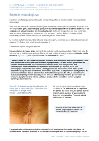 LES FONDAMENTAUX DE LA PATHOLOGIE DIGESTIVE
© CDU-HGE/Editions Elesevier-Masson - Octobre 2014
Toute reproduction ou traduction de l’ouvrage est interdite sans l’accord préalable de l’éditeur
Partie I : Les organes - Chapitre 5 : Rectum-Canal anal - Page 18/21
Examen proctologique
L’examen proctologique comporte quatre temps : l’inspection, le toucher rectal, l’anuscopie et la
rectoscopie.
Pour trois des temps de l’examen proctologique (inspection, anuscopie, rectoscopie), le patient doit
être en position genu-pectorale (les genoux et la poitrine reposent sur la table d’examen, et les
cuisses sont à la verticale) ou en décubitus latéral. Cette dernière position est plus confortable
pour le malade, physiquement (notamment pour les personnes très âgées ou impotentes) et
psychologiquement, mais la rectoscopie au tube rigide est moins aisée.
Le toucher anal et rectal peut être fait aussi en position genu-pectorale, ou en décubitus dorsal (voir
chapitre 19 « Points clefs en sémiologie digestive »).
L’examinateur porte des gants jetables.
L’inspection de la marge anale permet à elle seule de nombreux diagnostics, notamment celui de
fissure anale et de lésions de grattage. Elle se fait avec un bon éclairage, en écartant les plis radiés
de l’anus (figure 5.14) pour exposer la zone cutanée lisse de l’anus.
Figure 5.14 : Aspect normal des plis radiés de
l’anus (fins et harmonieux) lors de l’inspection
clinique de la marge anale
Source : Laurent Siproudhis
Le toucher rectal n’est normalement pas
douloureux. On examine par la palpation
les parois du canal anal, les parois du bas
rectum, ainsi que des organes voisins
(coccyx, prostate chez l’homme, et col
utérin chez la femme).
L’appareil sphinctérien est évalué au repos et lors d’une contraction anale volontaire. Le
toucher rectal permet d’atteindre le cul-de-sac de Douglas dont le contenu est perçu s’il est
La fissure anale est une ulcération siégeant au niveau de la muqueuse de la partie basse du canal
anal (zone située entre la peau périanale et la ligne pectinée). Elle a un aspect typiquement en
raquette à bords décollés. Son fond est habituellement atone, non bourgeonnant. Elle
s’accompagne habituellement d’une hypertonie du canal anal qui implique, sur le plan
physiologique, le sphincter anal interne. Cette hypertonie est douloureuse. Alors même que le
mécanisme inaugural reste indéterminé, on incrimine aujourd’hui la responsabilité de l’hypertonie du
sphincter anal interne dans la pérennisation de l’ischémie muqueuse. En effet, la vascularisation
muqueuse est principalement assurée par des rameaux artériolaires perforants qui traversent les
structures du sphincter anal interne. La fissure anale peut être considérée comme une plaie
ischémique de l’anoderme.
Au cours du toucher rectal chez la
femme, on peut palper l’utérus s’il
est fibromateux ou rétroversé.
 