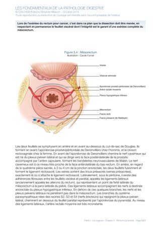 LES FONDAMENTAUX DE LA PATHOLOGIE DIGESTIVE
© CDU-HGE/Editions Elesevier-Masson - Octobre 2014
Toute reproduction ou traduction de l’ouvrage est interdite sans l’accord préalable de l’éditeur
Partie I : Les organes - Chapitre 5 : Rectum-Canal anal - Page 5/21
Figure 5.4 : Mésorectum
Illustration : Carole Fumat
Les deux feuillets se symphysent en arrière et en avant au-dessous du cul-de-sac de Douglas. Ils
forment en avant l’aponévrose prostatopéritonéale de Denonvilliers chez l’homme, et la cloison
rectovaginale chez la femme. En avant de l’aponévrose de Denonvilliers chemine le nerf caverneux qui
est né du plexus pelvien latéral et qui se dirige vers la face postérolatérale de la prostate,
accompagné par l’artère capsulaire, formant les bandelettes neurovasculaires de Walsh. Le nerf
caverneux est à ce niveau très proche de la face antérolatérale du bas rectum. En arrière, en regard
de la quatrième pièce sacrée, à 3 ou 4 cm de la jonction anorectale, les deux feuillets fusionnent et
forment le ligament rectosacré. Les veines sortent des trous présacrés (veines présacrées),
exactement là où s’attache le ligament rectosacré. Latéralement, sous le péritoine, il existe des
adhérences fibreuses entre les feuillets viscéral et pariétal, appelés les ligaments latéraux
(anciennement appelés les ailerons du rectum), qui représentent un point de fixité latérale du
mésorectum à la paroi latérale du pelvis. Ces ligaments latéraux accompagnent les nerfs à destinée
anorectale du plexus hypogastrique inférieur. En dehors de ces quelques branches, les nerfs et les
plexus pelviens latéraux ne pénètrent pas dans le mésorectum. Les branches du système
parasympathique nées des racines S2, S3 et S4 (nerfs érecteurs) qui rejoignent le plexus pelvien
latéral, cheminent en dessous du feuillet pariétal représenté par l’aponévrose du pyramidal. Au niveau
des ligaments latéraux, l’artère rectale moyenne est très inconstante.
Vessie
Vésicule séminale
Aponévrose prostato-péritonéale (de Denonvilliers)
Artère rectale moyenne
Plexus hypogastrique inférieur
Mésorectum
Fascia rectii
Fascia présacré (de Waldeyer)
Lors de l’exérèse du rectum pour cancer, c’est dans ce plan que la dissection doit être menée, en
respectant en permanence le feuillet viscéral dont l’intégrité est le garant d’une exérèse complète du
mésorectum.
 