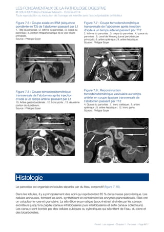 LES FONDAMENTAUX DE LA PATHOLOGIE DIGESTIVE
© CDU-HGE/Editions Elesevier-Masson - Octobre 2014
Toute reproduction ou traduction de l’ouvrage est interdite sans l’accord préalable de l’éditeur
Partie I : Les organes - Chapitre 7 : Pancréas - Page 6/17
Figure 7.6 : Coupe axiale en IRM (séquence
pondérée en T2) de l’abdomen passant par L1
1. Tête du pancréas ; 2. isthme du pancréas ; 3. corps du
pancréas ; 5. portion intrapancréatique de la voie biliaire
principale.
Source : Philippe Soyer
Figure 7.8 : Coupe tomodensitométrique
transversale de l’abdomen après injection
d’iode à un temps artériel passant par L1
10. Artère gastroduodénale ; 12. tronc porte ; 13. deuxième
portion du duodénum.
Source : Philippe Soyer
Figure 7.7 : Coupe tomodensitométrique
transversale de l’abdomen après injection
d’iode à un temps artériel passant par T12
2. Isthme du pancréas ; 3. corps du pancréas ; 4. queue du
pancréas ; 6. canal de Wirsung (canal pancréatique
principal) ; 8. artère splénique ; 9. artère hépatique.
Source : Philippe Soyer
Figure 7.9 : Reconstruction
tomodensitométrique vasculaire au temps
artériel en coupe épaisse transversale de
l’abdomen passant par T12
4. Queue du pancréas ; 7. tronc cœliaque ; 8. artère
splénique ; 9. artère hépatique ; 12. tronc porte.
Source : Philippe Soyer
Histologie
Le pancréas est organisé en lobules séparés par du tissu conjonctif (figure 7.10).
Dans les lobules, il y a principalement des acini qui représentent 85 % de la masse pancréatique. Les
cellules acineuses, formant les acini, synthétisent et contiennent les enzymes pancréatiques. Elles ont
un cytoplasme rose et granulaire. La sécrétion enzymatique (exocrine) est drainée par les canaux
excréteurs jusqu’à la papille (canaux intralobulaires puis interlobulaires et enfin canaux collecteurs).
Les canaux sont bordés par des cellules cubiques ou cylindriques qui sécrètent de l’eau, du clore et
des bicarbonates.
 