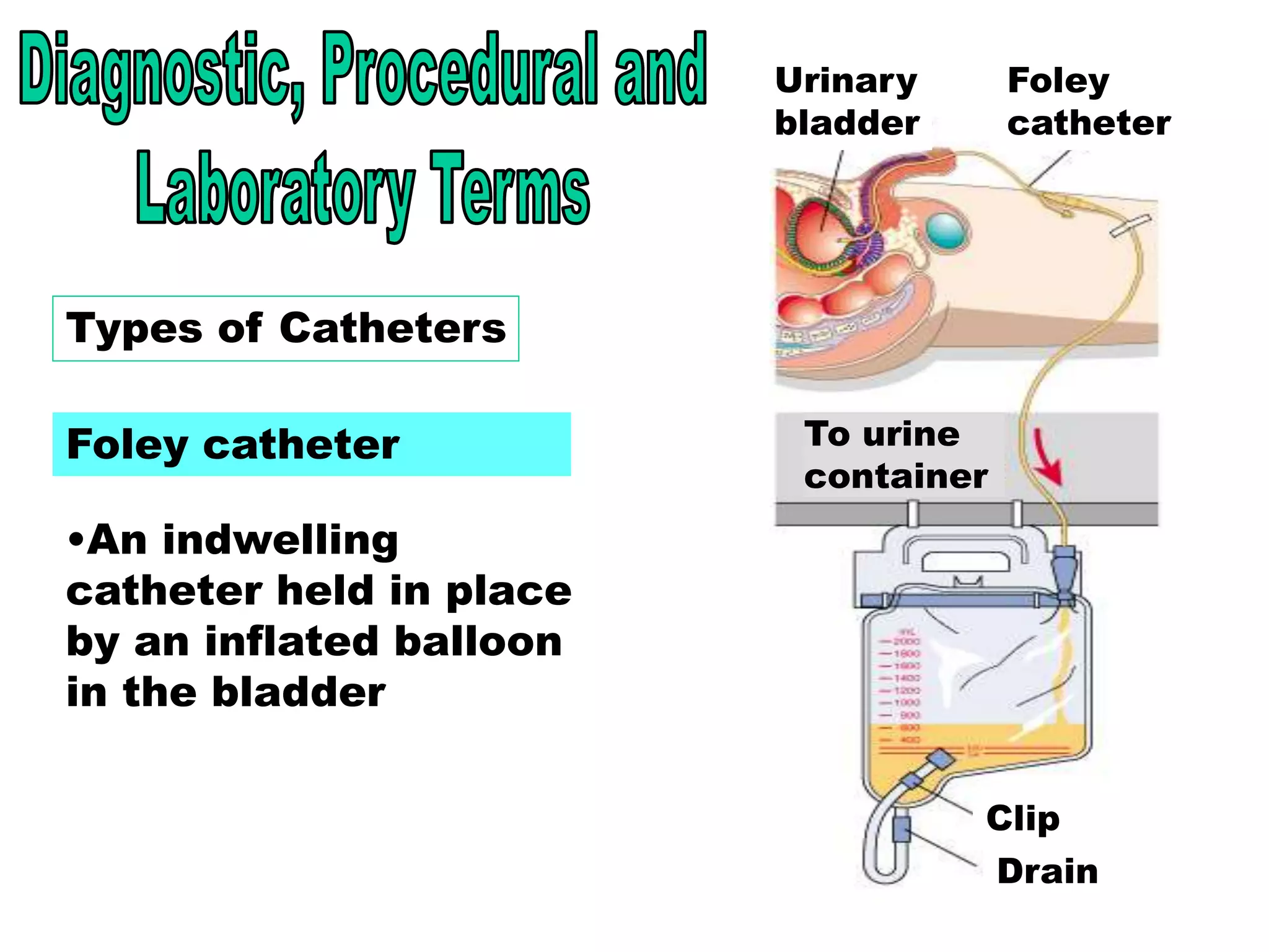 21
Types of Catheters - Foley
Types of Catheters
Foley catheter
•An indwelling
catheter held in place
by an inflated balloon
in the bladder
Urinary
bladder
Foley
catheter
To urine
container
Clip
Drain
 