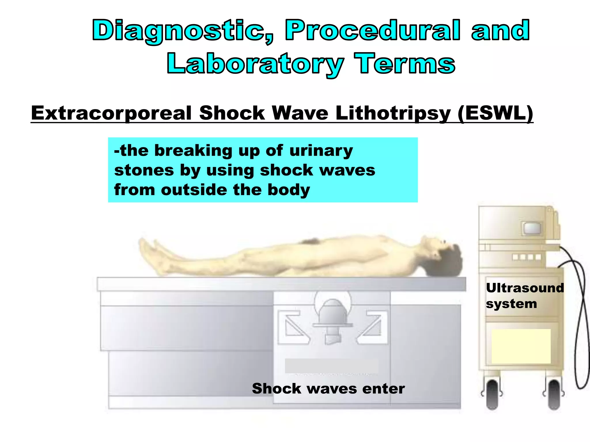 26
ESWL
Extracorporeal Shock Wave Lithotripsy (ESWL)
-the breaking up of urinary
stones by using shock waves
from outside the body
Shock waves enter
Ultrasound
system
 