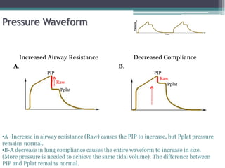 Increased Airway Resistance Decreased Compliance
PIP
Pplat
PIP
Pplat
A. B.
•A -Increase in airway resistance (Raw) causes the PIP to increase, but Pplat pressure
remains normal.
•B-A decrease in lung compliance causes the entire waveform to increase in size.
(More pressure is needed to achieve the same tidal volume). The difference between
PIP and Pplat remains normal.
Pressure Waveform
Raw
Raw
 