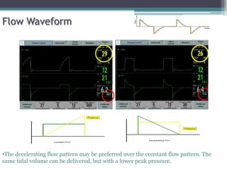 Flow Waveform
•The decelerating flow pattern may be preferred over the constant flow pattern. The
same tidal volume can be delivered, but with a lower peak pressure.
 