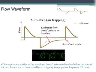 Flow Waveform
Auto-Peep (air trapping)
•If the expiratory portion of the waveform doesn’t return to baseline before the start of
the next breath starts, there could be air trapping. (emphysema, improper I:E ratio)
Start of next breath
Expiratory flow
doesn’t return to
baseline
= Normal
 