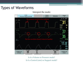 Is it a Volume or Pressure mode?
Is it a Control (rate) or Support mode?
Interpret the mode:
Types of Waveforms
The pressure waveform has a plateau
The flow waveform doesn't return to baseline
 