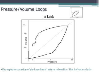 15 30
5
Pressure/Volume Loops
A Leak
•The expiratory portion of the loop doesn’t return to baseline. This indicates a leak.
500
250
 