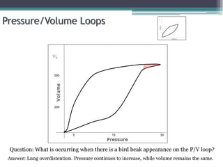 Pressure/Volume Loops
15 30
5
Question: What is occurring when there is a bird beak appearance on the P/V loop?
Answer: Lung overdistention. Pressure continues to increase, while volume remains the same.
500
250
 