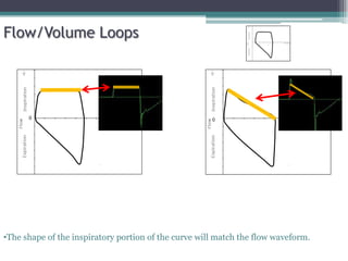 0 0
Flow/Volume Loops
•The shape of the inspiratory portion of the curve will match the flow waveform.
 