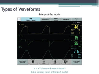 Is it a Volume or Pressure mode?
Is it a Control (rate) or Support mode?
Interpret the mode:
Types of Waveforms
 