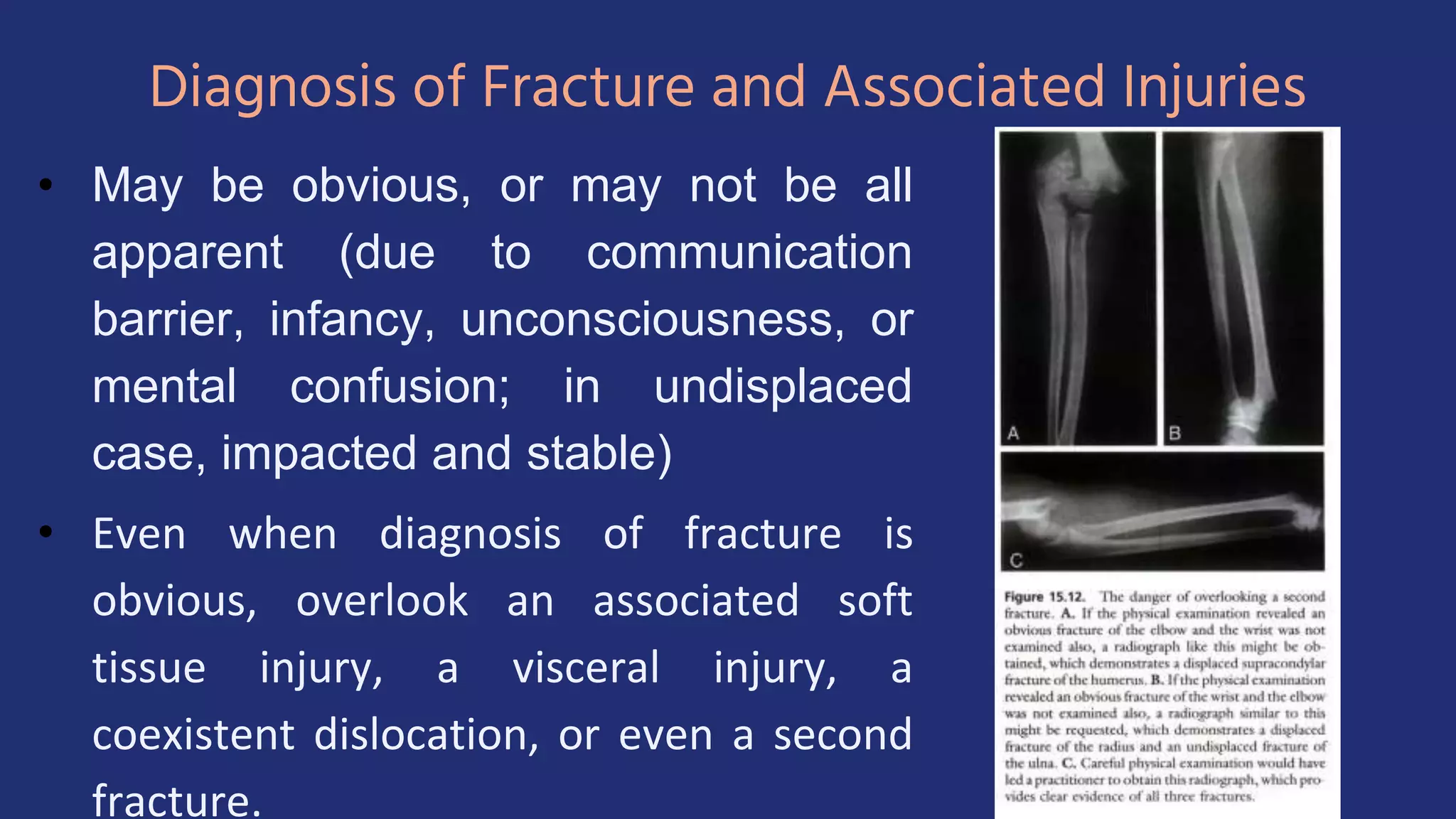 Diagnosis of Fracture and Associated Injuries
• May be obvious, or may not be all
apparent (due to communication
barrier, infancy, unconsciousness, or
mental confusion; in undisplaced
case, impacted and stable)
• Even when diagnosis of fracture is
obvious, overlook an associated soft
tissue injury, a visceral injury, a
coexistent dislocation, or even a second
fracture.
 